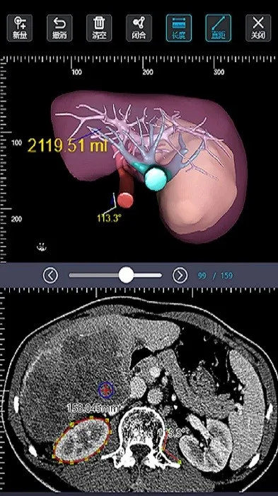 ��Ӱ2026�ٷ����°汾v1.1.21 �ֻ���