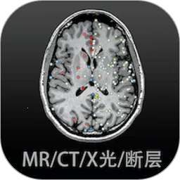 Ӱ�����ͼ��(ҽѧ����ѧϰ����)v4.5.8 ��Ѱ�