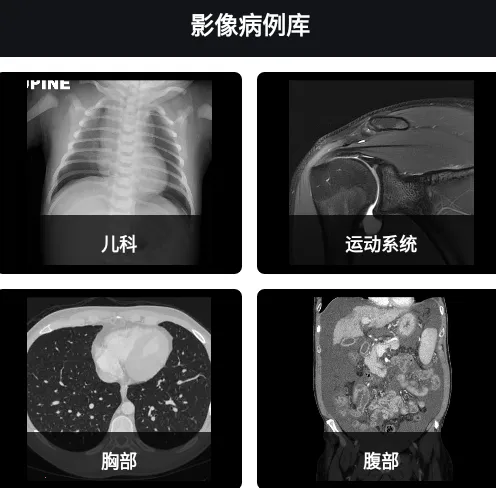 Ӱ�����ͼ��(ҽѧ����ѧϰ����)